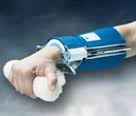 Wrist Extension Splint (padded hand attachment)