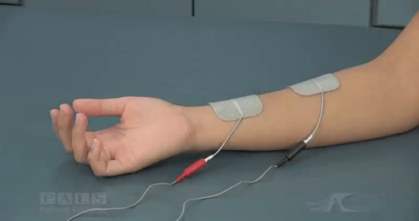 Electrode Placement for Muscle Stimulation