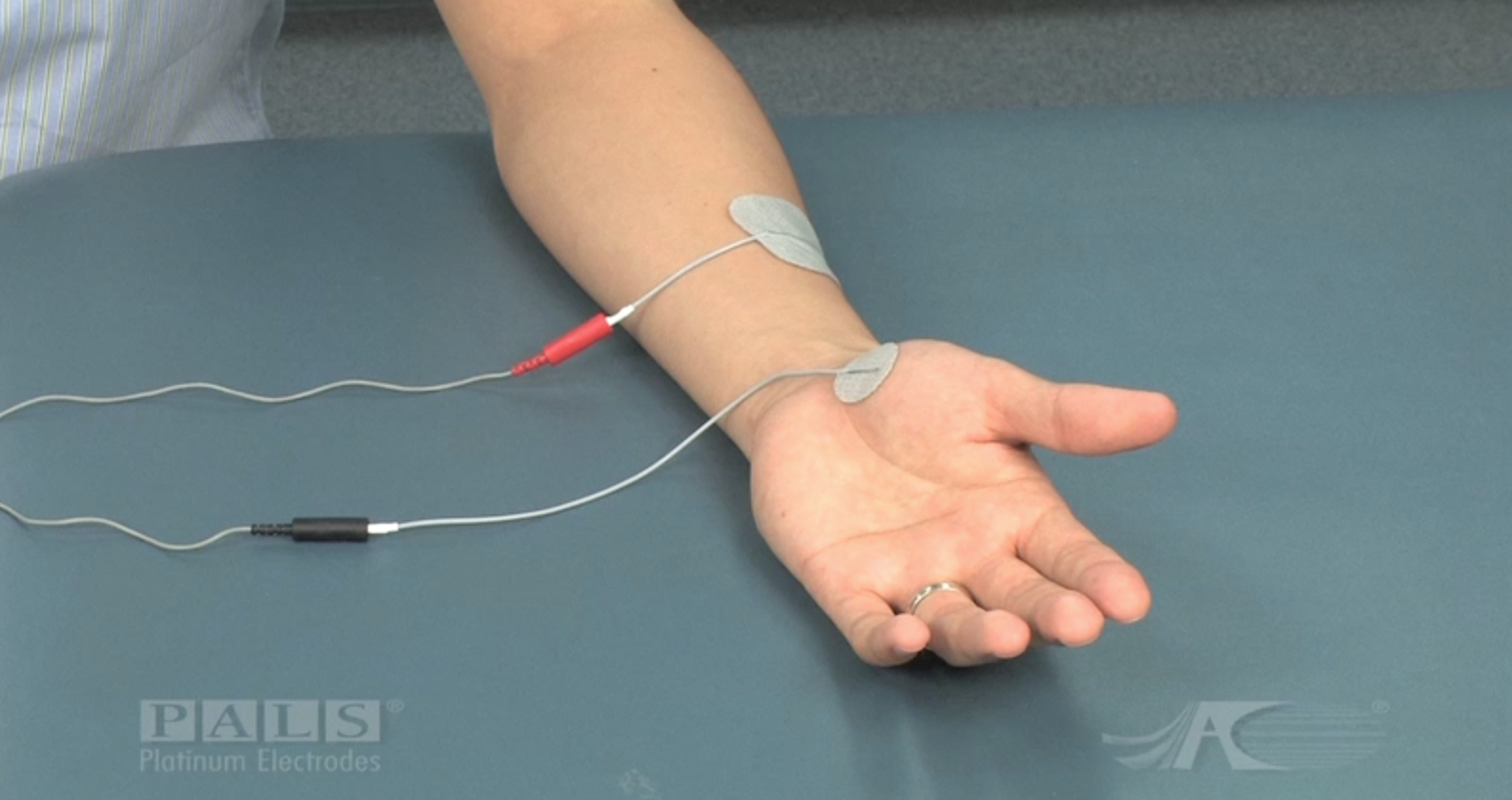 Neuromuscular electrical stimulation (NMES) electrode. a, NMES