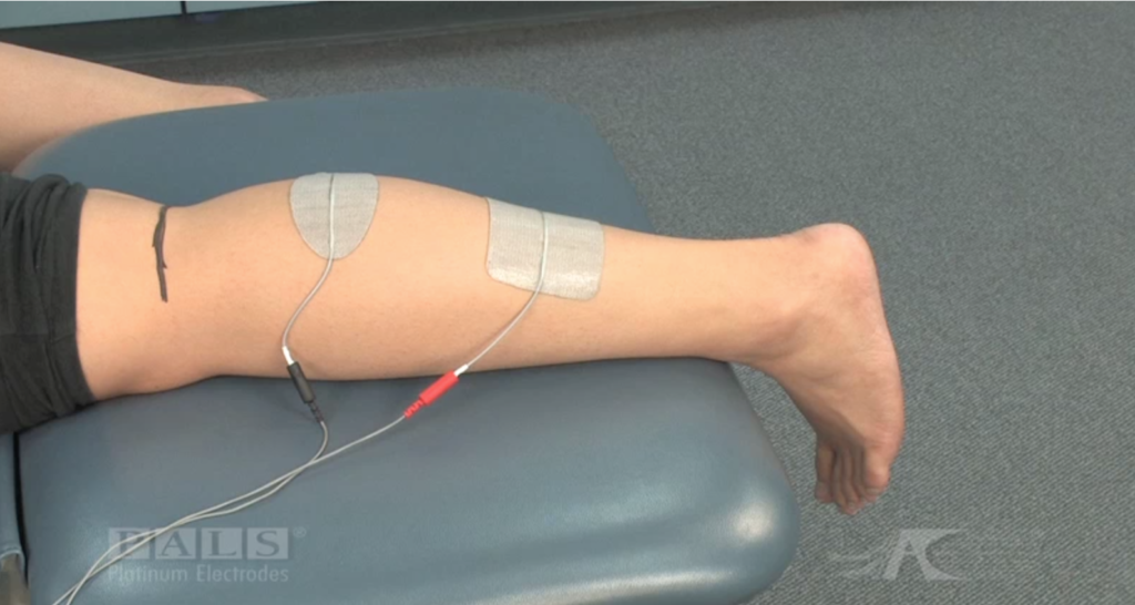 Best Electrode Position and Placement for Leg and Foot Stroke